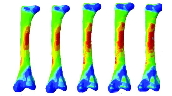 Biomechanical Engineering of Human Bones and the aftermath of Covid-19