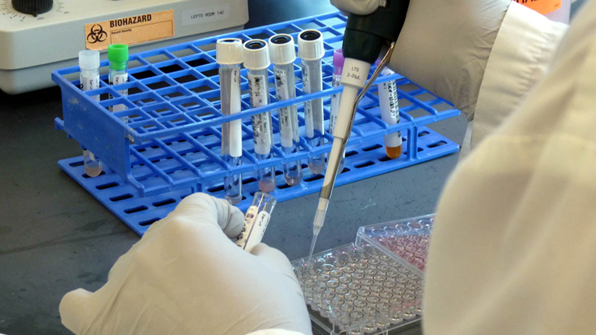 Figure 2: Sample preparation and DNA extraction for Arms PCR