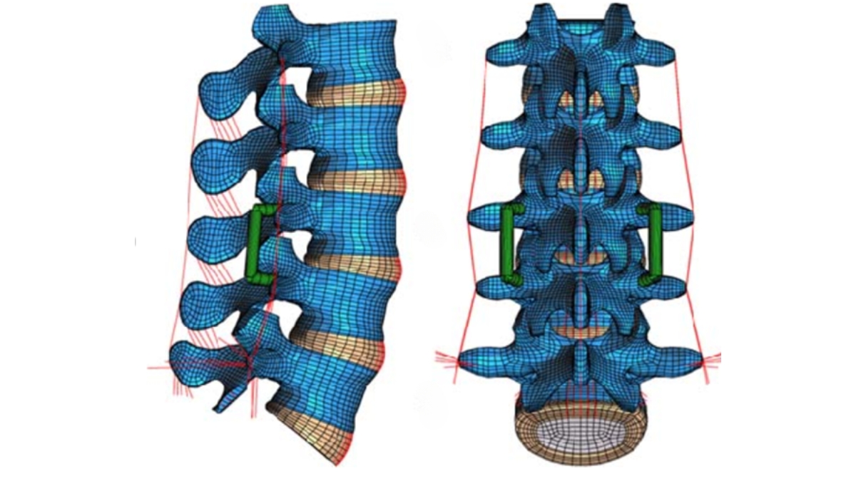 Biomechanics of cricket for athlete’s well being