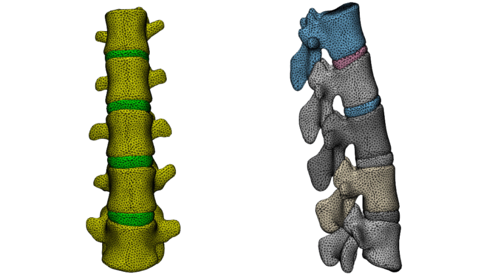 Figure 2: Finite element model for the lumbar spine