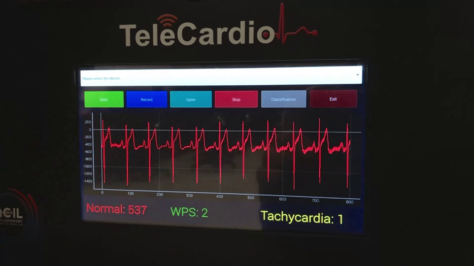 Figure 2: ECG arrhythmia detection and visualization using TeleCardio