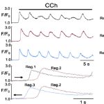 Figure 3: (B) Time dependent changes of Fluo-4 fluorescence induced by CCh in three parts of EC with (C) superimposed traces of initial Ca2+ spike