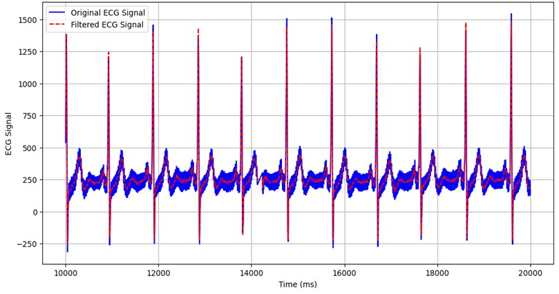 Figure 4: ECG filtration performed by TeleCardio