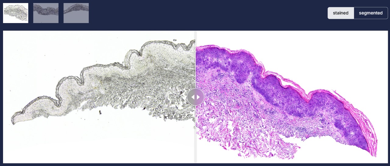 Skin Science Visual DERMA-VISION: Transforming Skin Pathology with AI-Powered Innovation ...