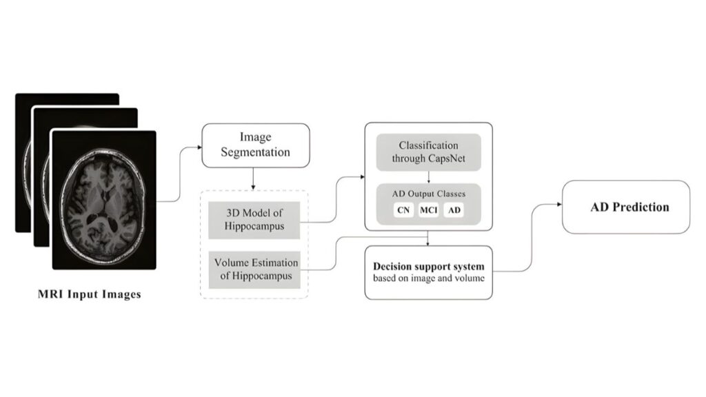 Figure 4: Proposed Framework for Alzheimer Disease Classification